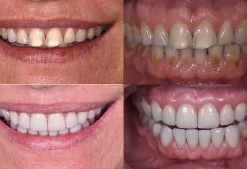 1copiepng_63d6961317df6